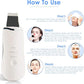 3-in-1 Ultrasonic Facial Skin Scrubber